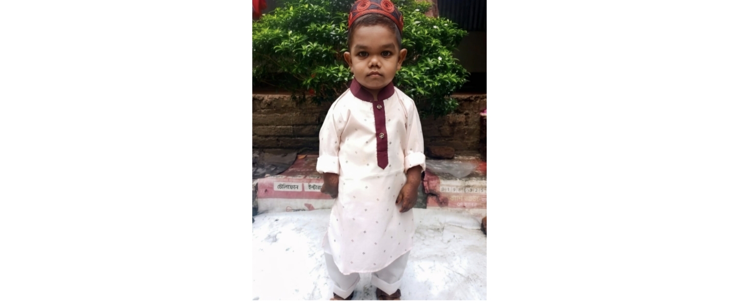 ১৯ বছর বয়স, তবু শিশুর মতো শরীর