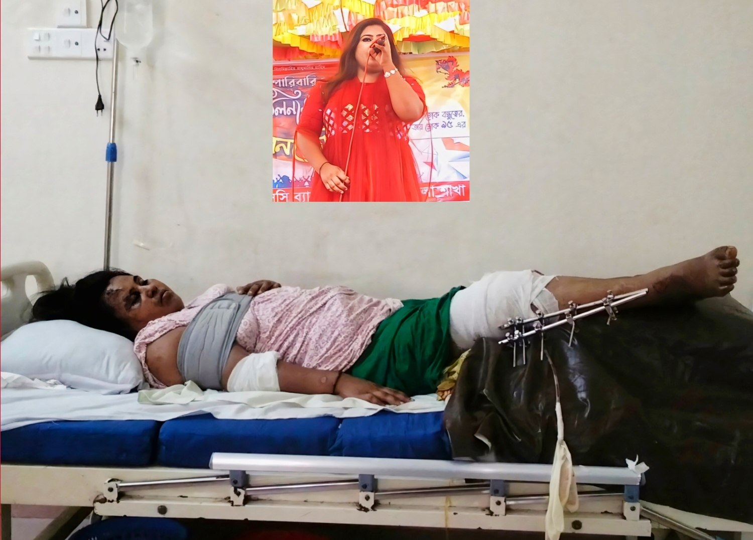 কুড়িগ্রামে সড়ক দুর্ঘটনায় আশঙ্কাজনক সংগীতশিল্পী স্মৃতি জান্নাত, অর্থের অভাবে চিকিৎসা বন্ধের উপক্রম